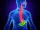 What is Gastroesophageal?