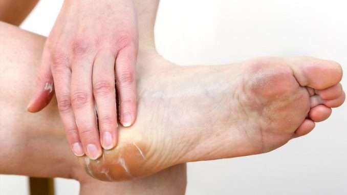 How to remove thick dead skin from feet.