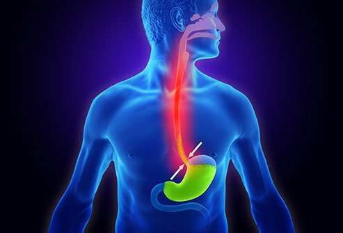 What is Gastroesophageal?