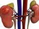 What is kidney failure?