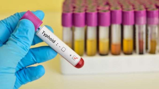 What is Typhoid?