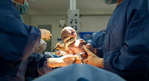 Caesarean section in relation to normal delivery.