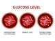 Blood sugar glucose