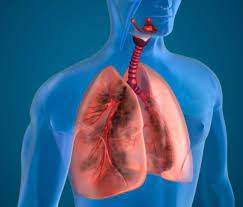Tuberculosis effects