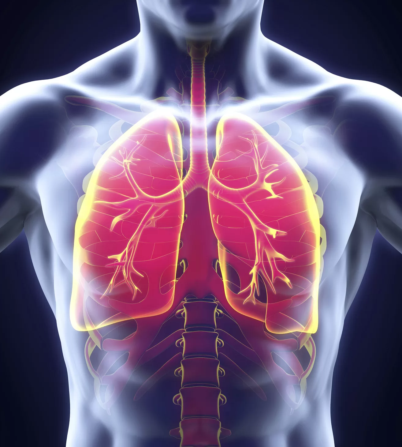 What is pneumonia, causes, types, symptoms, effects?