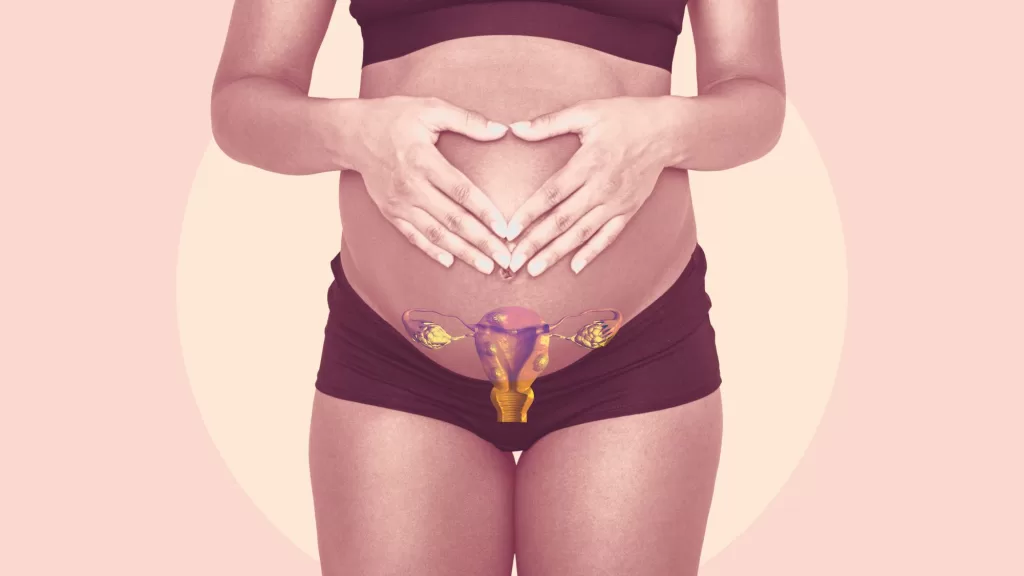 Fibroids images