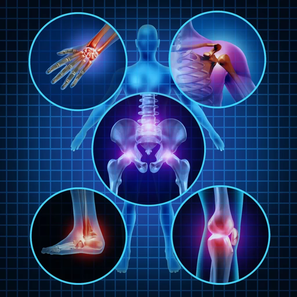 Types of arthritis