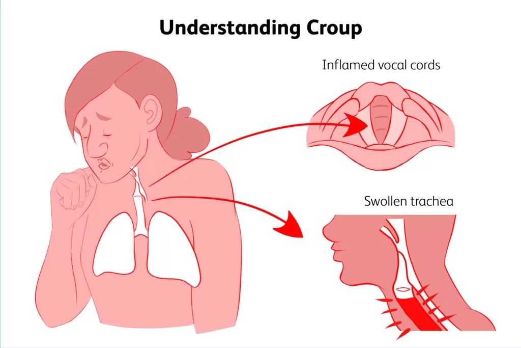 Croup images