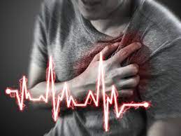 Cardiac arrest image