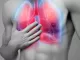 Acute Respiratory Distress Syndrome jpg